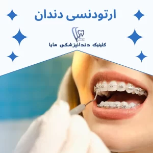 ارتودنسی دندان چیست و بهترین مرکز ارتودنسی در شمال تهران کلینیک مایا